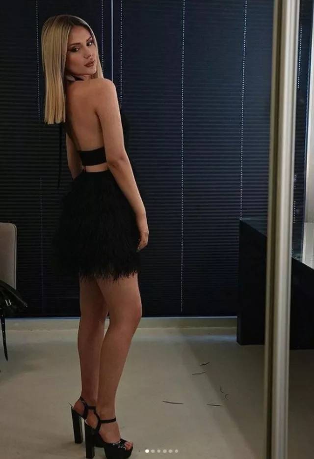 Kısmetse Olur'dan diskalifiye edilen Aybüke Çangal'ın estetiksiz hali ifşalandı! Kısmetse olur Aybüke estetik yaptırdı mı? 2